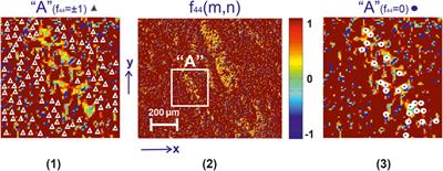 Polarization-Singular Approach to Imaging Mueller-Matrix Polarimetry in the Differential Diagnosis of Histological Sections of Biopsy of Tumors of the Uterus and Prostate